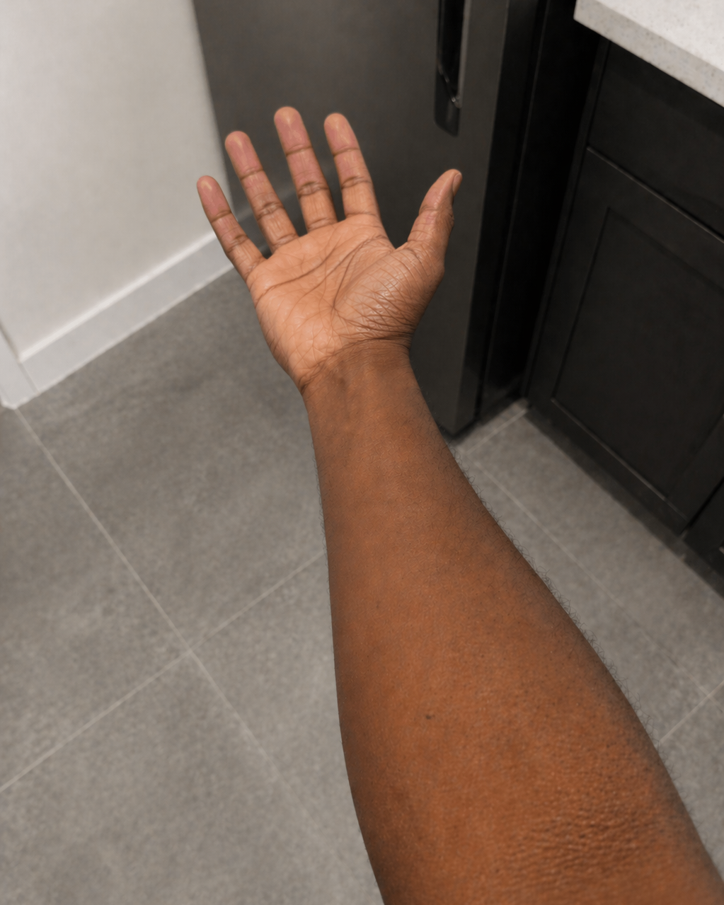 After · 30 days